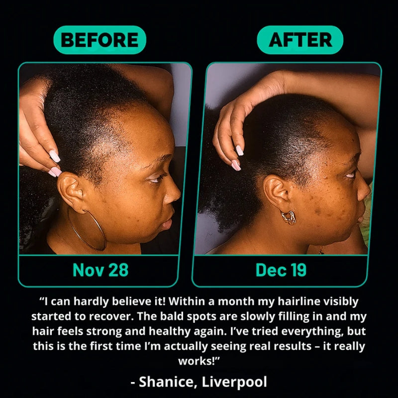 Batana Oil – Naturally Stronger, Shinier, Thicker Hair