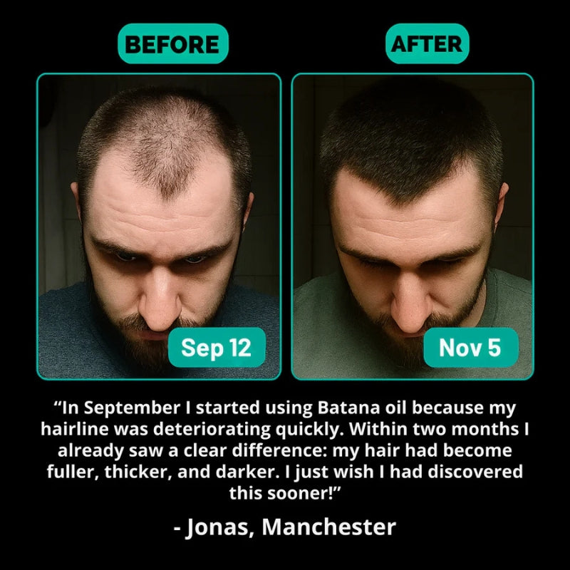 Batana Oil – Naturally Stronger, Shinier, Thicker Hair