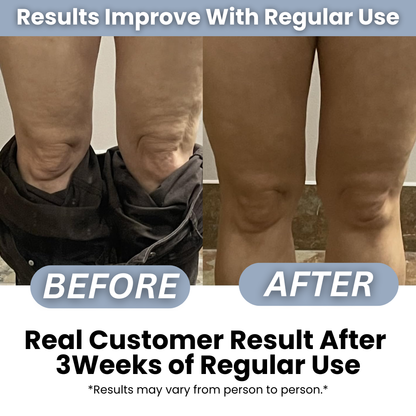 Anti-Cellulite Massage Roller